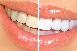 cosmetic dentistry