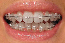 orthodontics