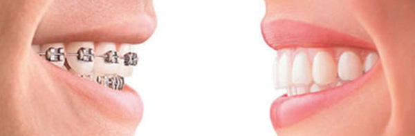vudent orthodontics