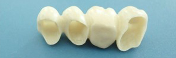vudent prosthetic